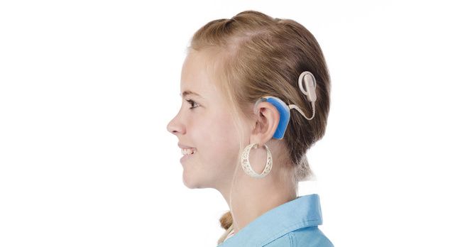 澳洲研究者将实现教失聪婴儿与人工耳蜗对话